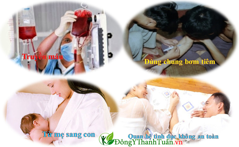 Những con đường lây nhiễm của viêm gan B Những con đường lây nhiễm của viêm gan B